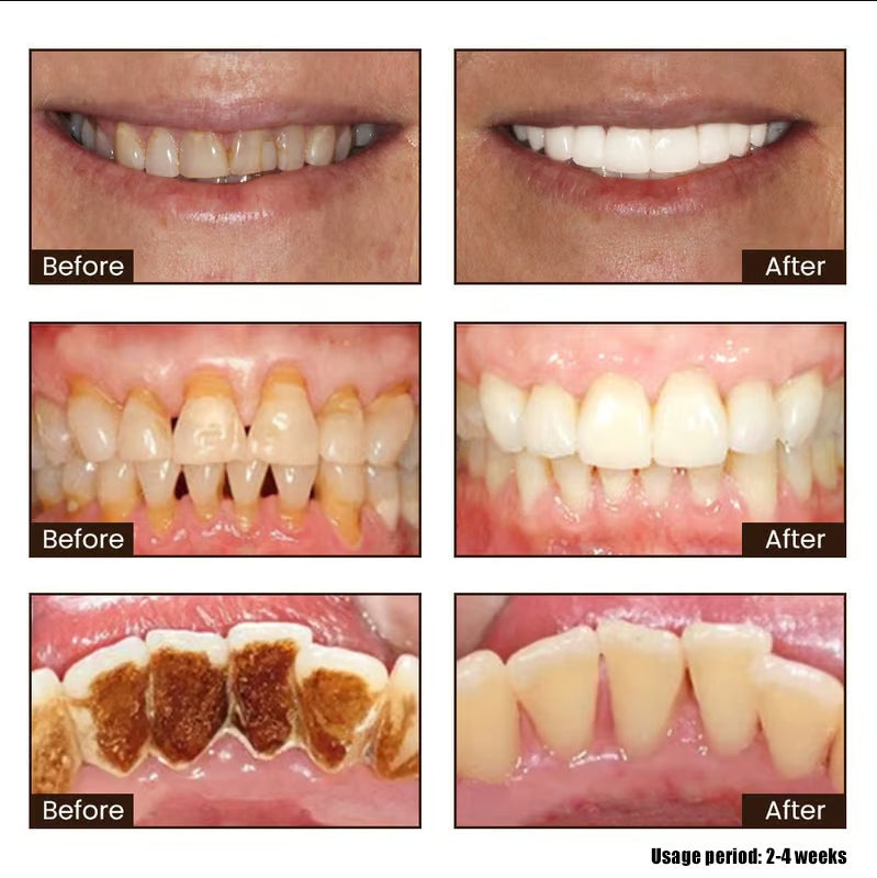 Cvreoz®Niacinamide Whitening Toothpaste-max