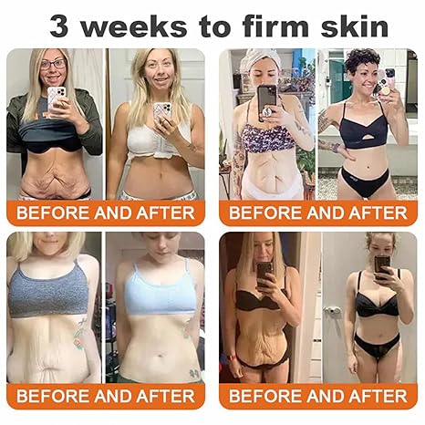 Bee venom skin repair cream, advanced firming and anti-wrinkle, professional bee venom skin care cream, natural bee venom comprehensive cream, suitable for all skin types