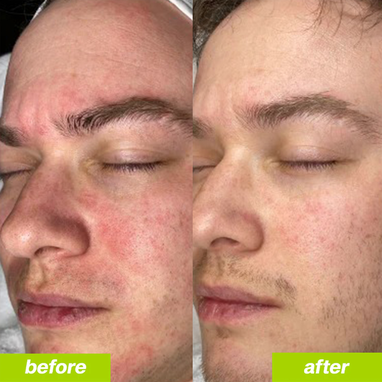 Uvora - Milk Thistle Detox 2.0, 2026 Upgraded Milk Thistle Tablets with 90 Tablets, Contains Multiple Natural Ingredients, Provides Support to the Body, Suitable for Men and Women